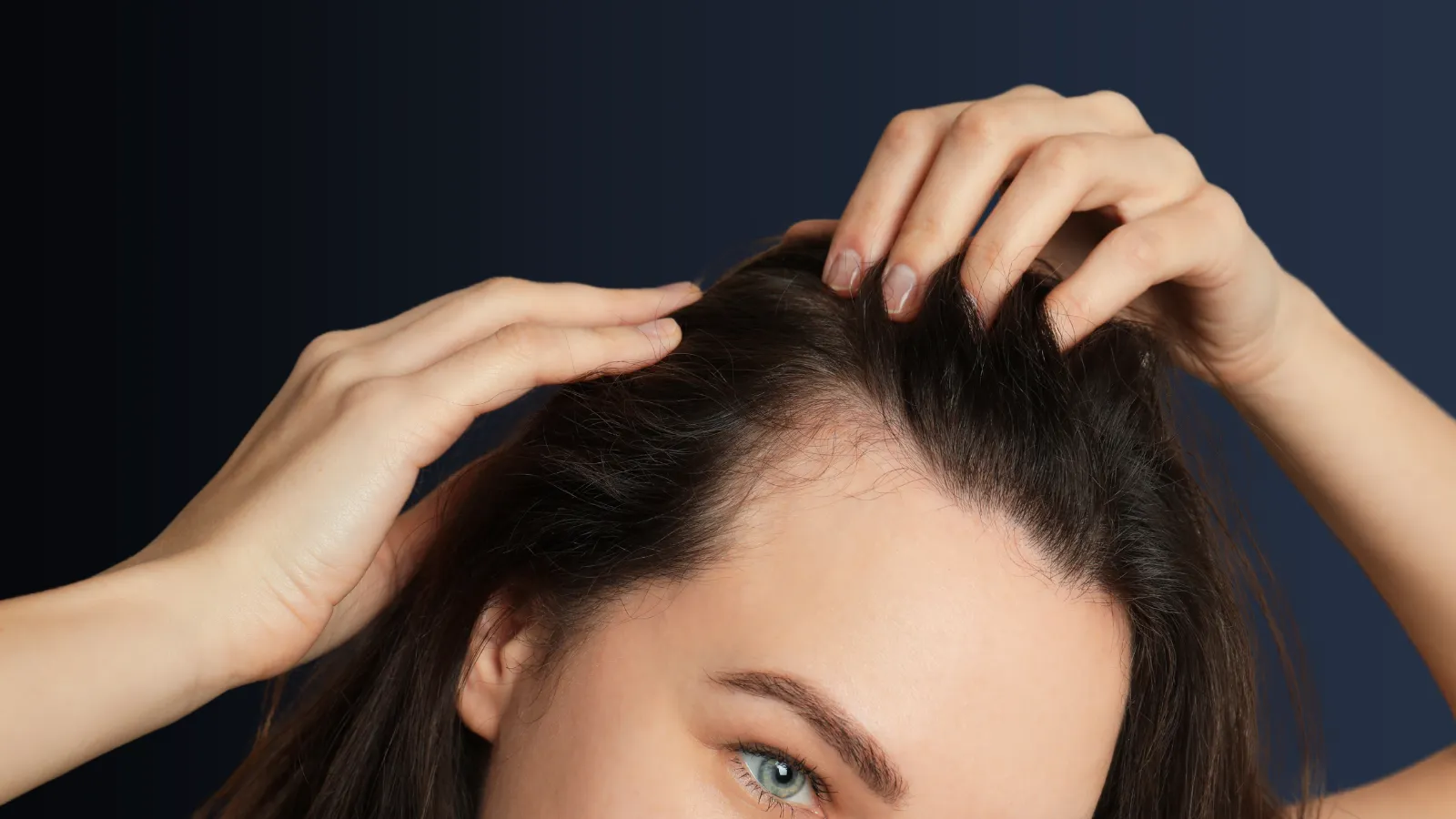 محدودیت‌های کاشت مو در بانوان