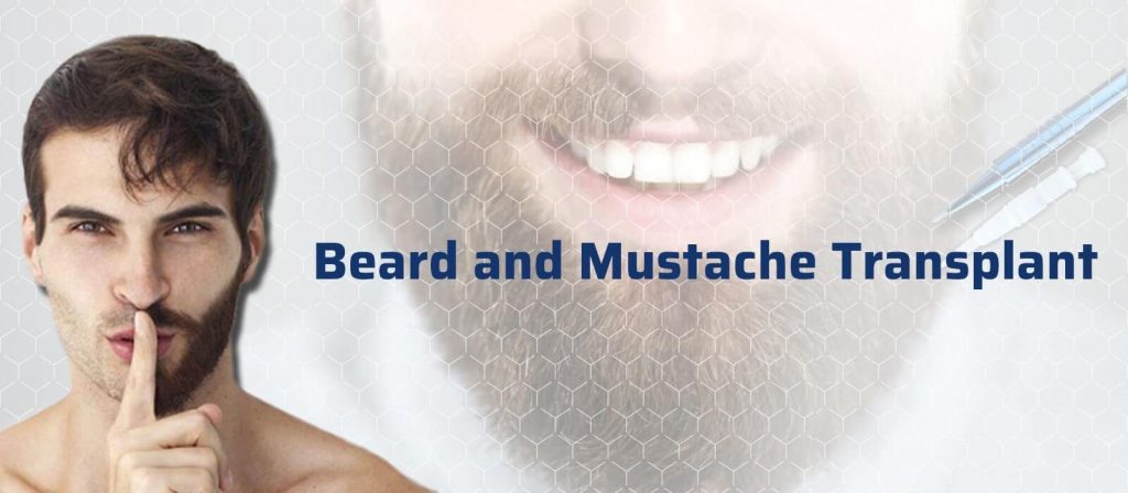 کاشت ریش و سبیل