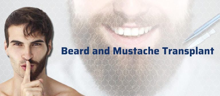 کاشت ریش و سبیل