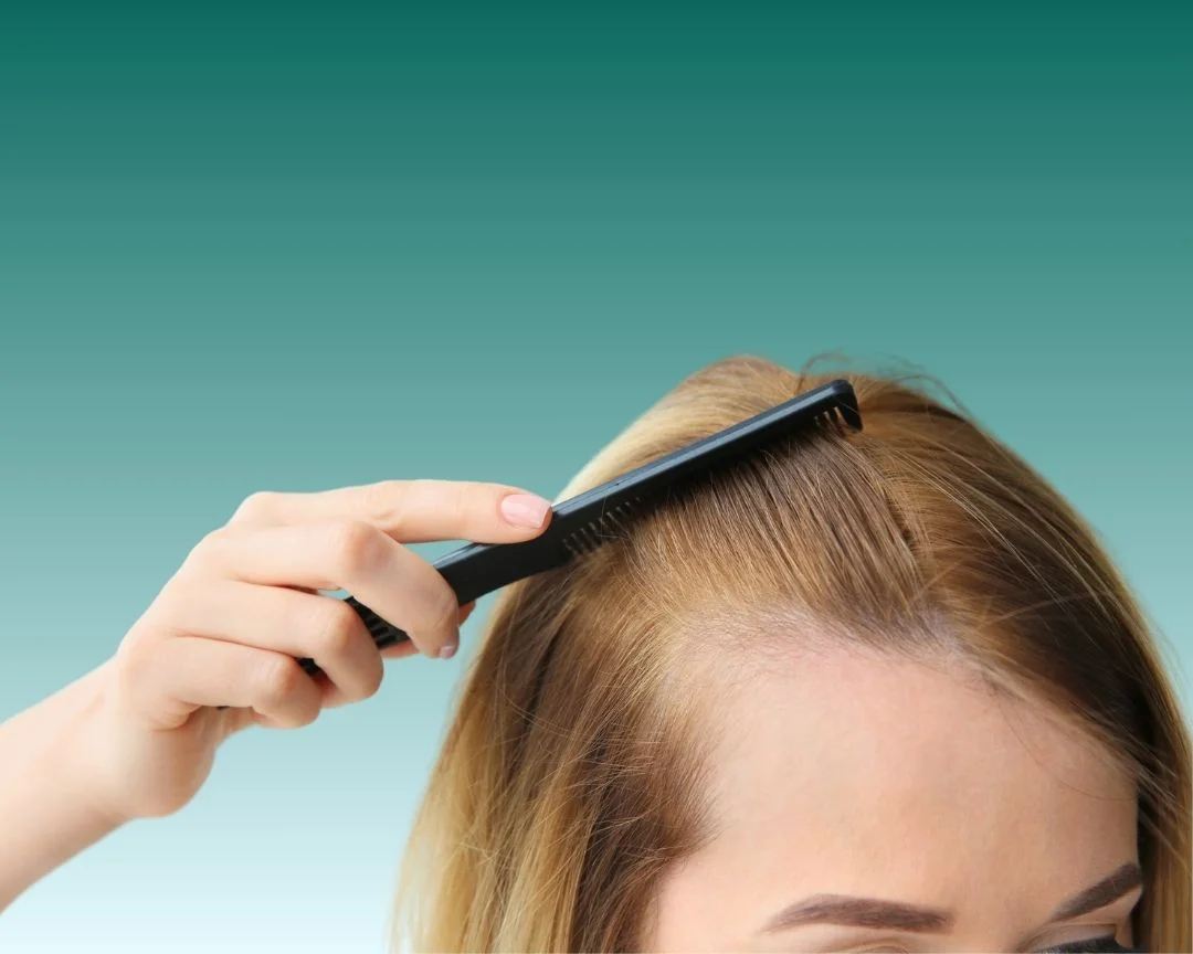 نتایج واقعی کاشت مو برای خانم‌ها؛ چه انتظاری داشته باشیم؟