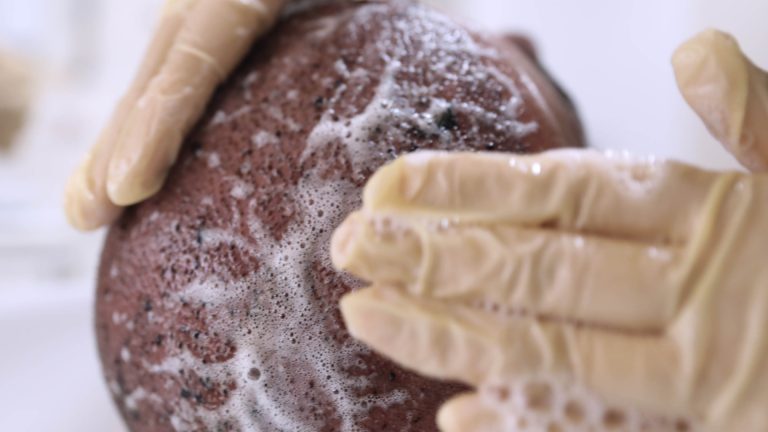 شامپو بعد از کاشت مو