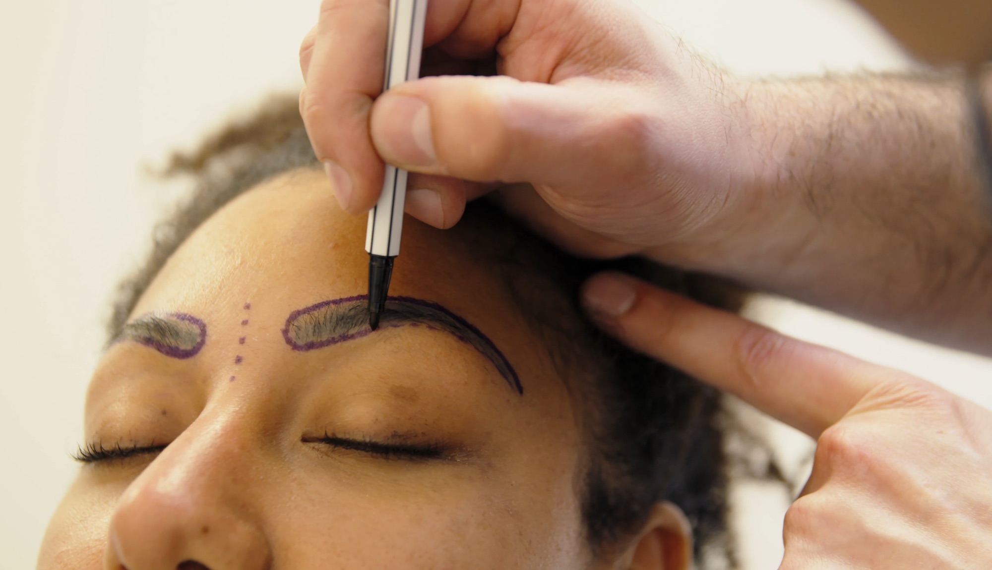 سوالات متداول درباره کاشت ابرو DHI