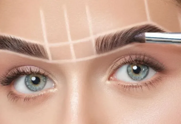 Eyebrow transplantation